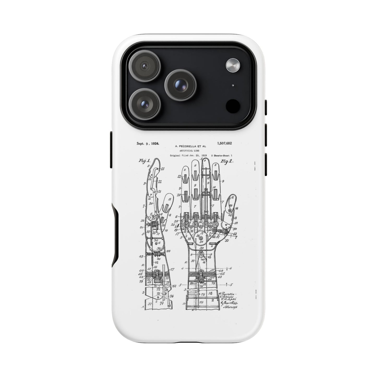 Anatomical Palm Patent Tough Phone Case — Vintage Hand Diagram iPhone Case