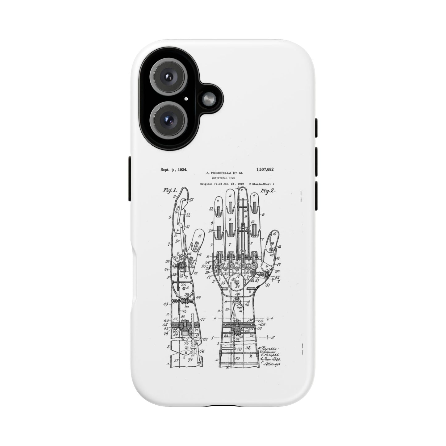 Anatomical Palm Patent Tough Phone Case — Vintage Hand Diagram iPhone Case