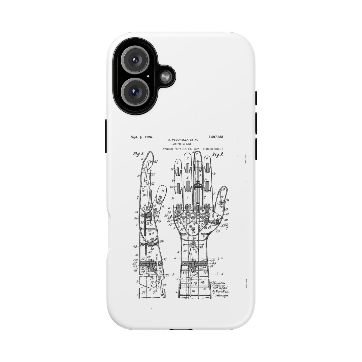 Anatomical Palm Patent Tough Phone Case — Vintage Hand Diagram iPhone Case