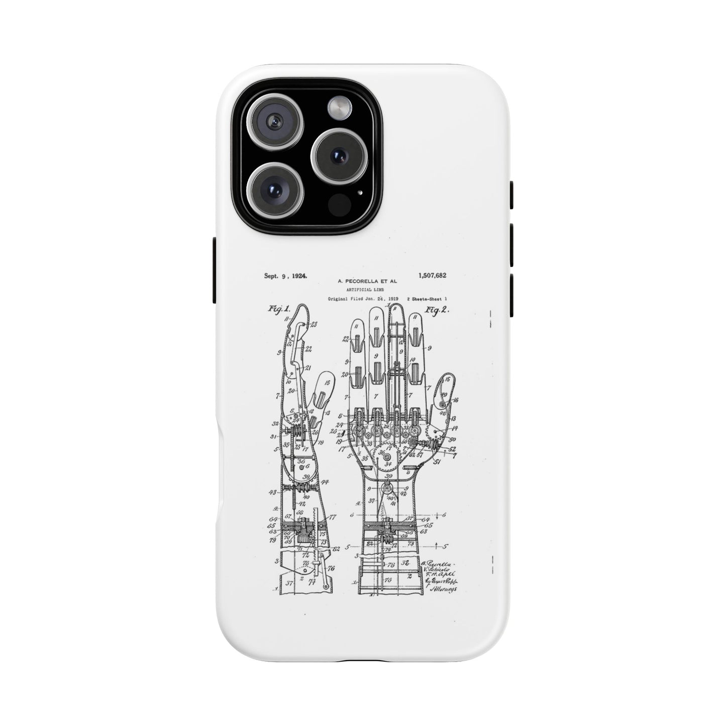 Anatomical Palm Patent Tough Phone Case — Vintage Hand Diagram iPhone Case