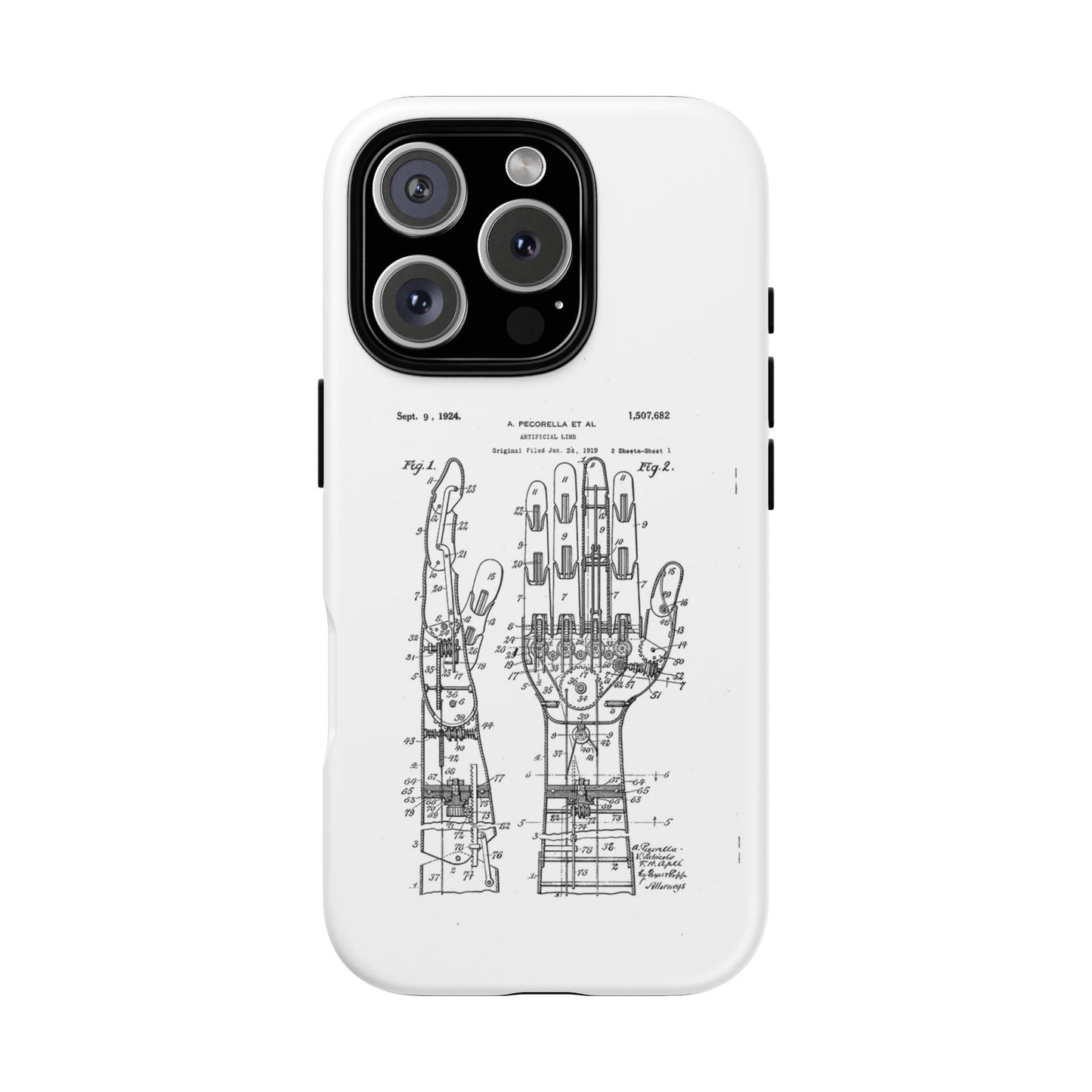 Anatomical Palm Patent Tough Phone Case — Vintage Hand Diagram iPhone Case