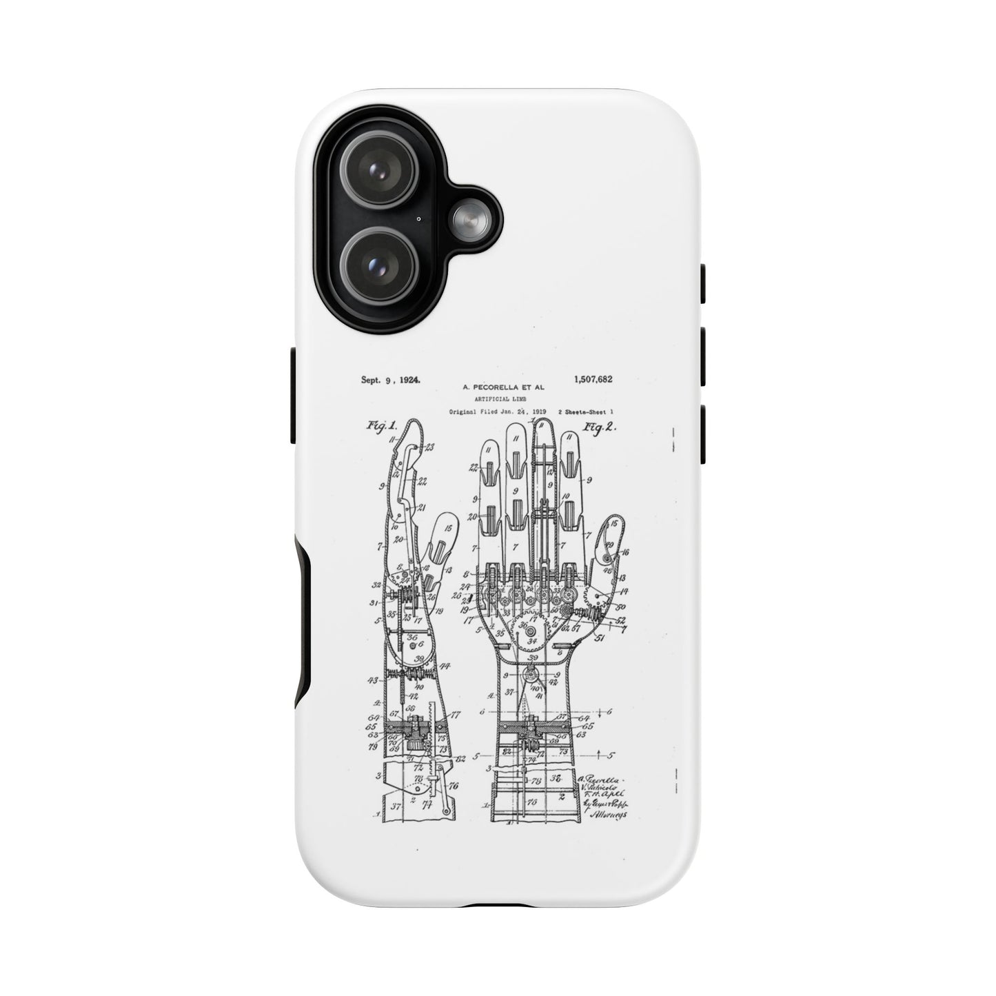 Anatomical Palm Patent Tough Phone Case — Vintage Hand Diagram iPhone Case